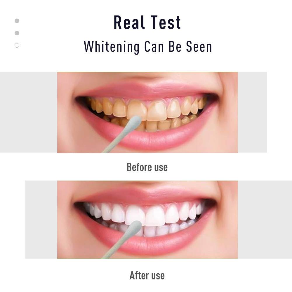 Làm Trắng Răng Bút Răng Gel Tr - đánh giá và giá Whitening Pen Bleach