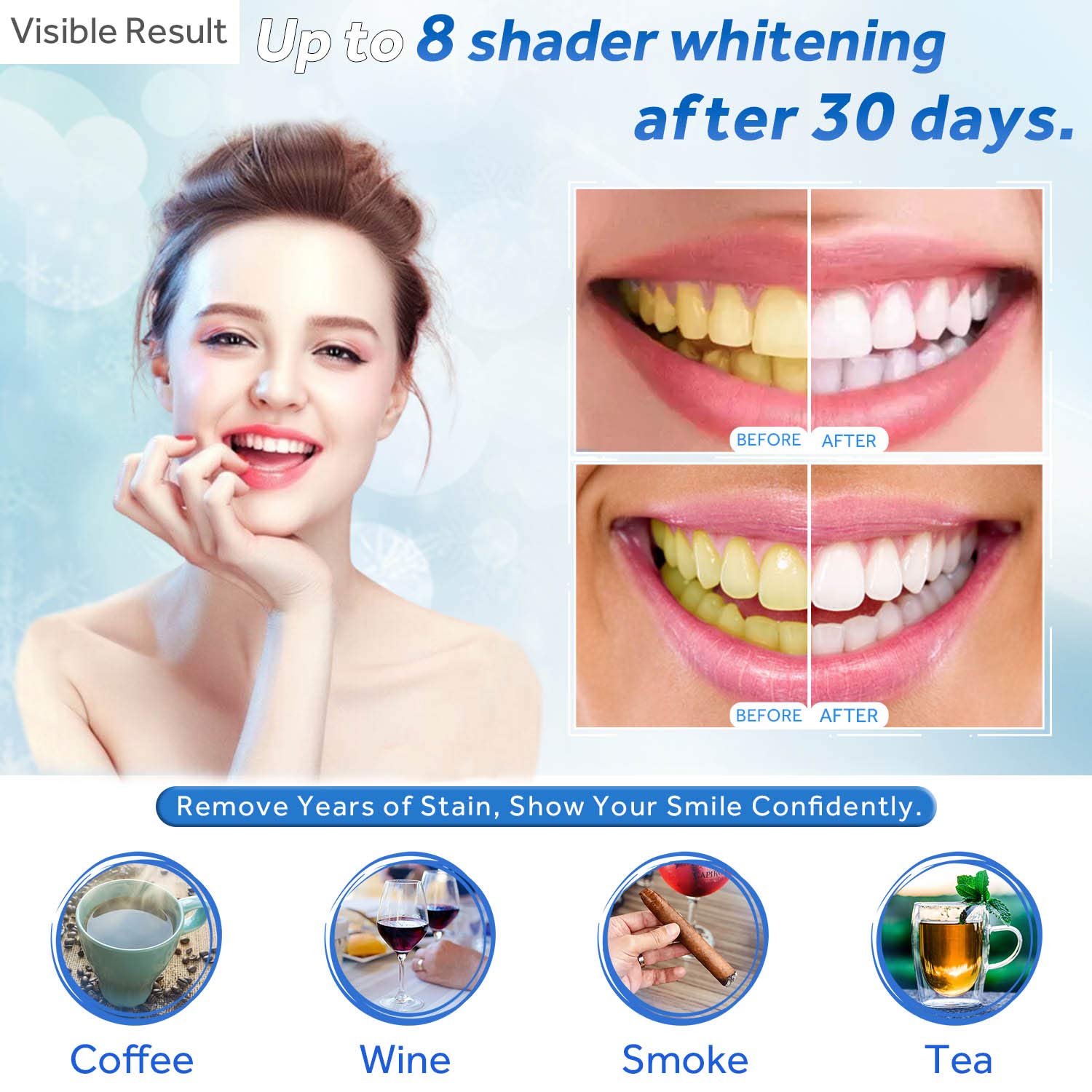 Teeth Whitening Gel Refill Syr - đánh giá và giá Teeth Whitening Ai