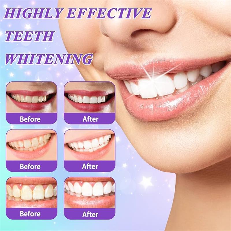 9D Purple Teeth Whitening Toot - đánh giá và giá Teeth Whitening That Works