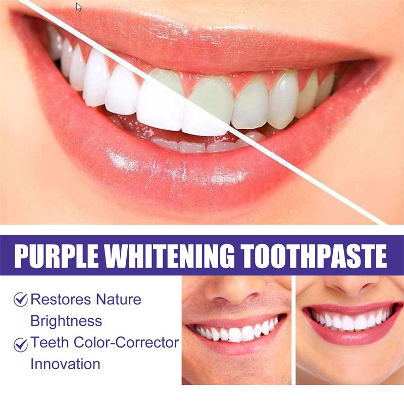 9D Purple Teeth Whitening Toot - đánh giá và giá Teeth Whitening That Works