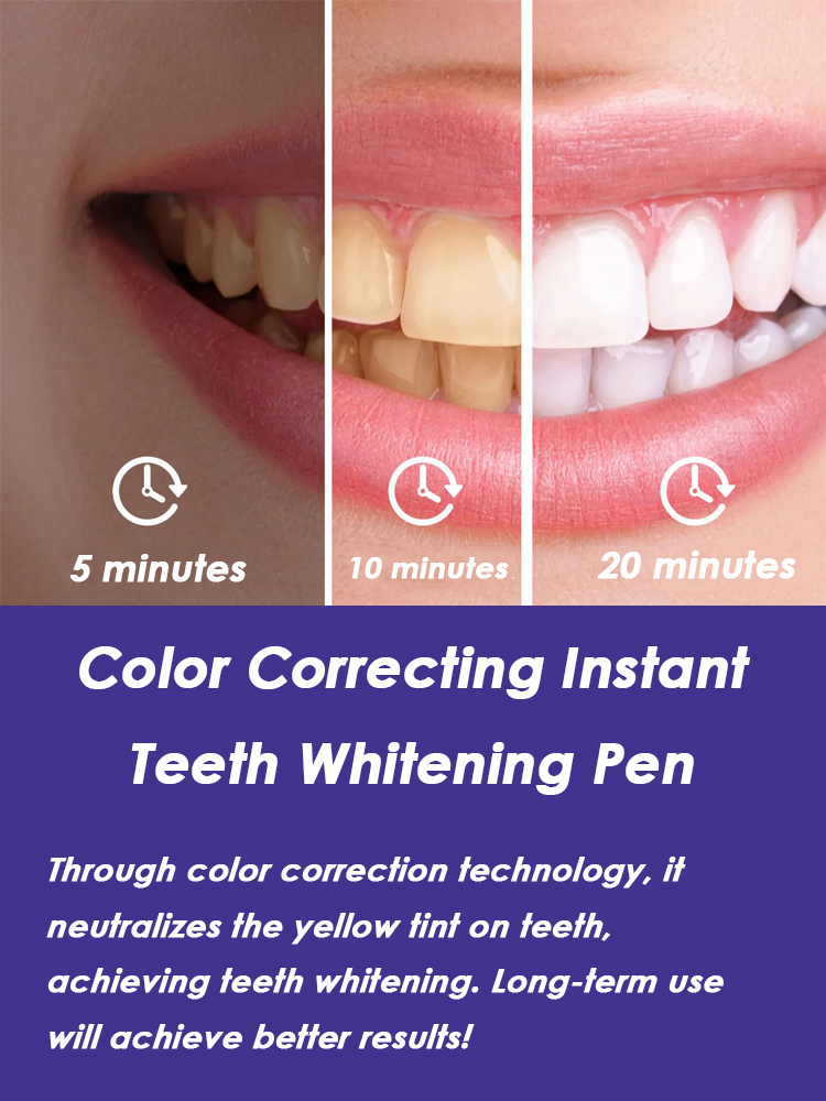 Teeth Whitening Pen Effective  - đánh giá và giá Whitening Pen Bleach