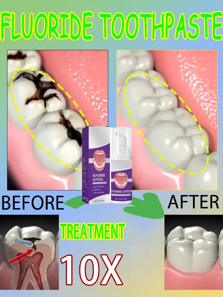 Hot sales Best-selling, Scient - đánh giá và giá Teeth Whitening That Works