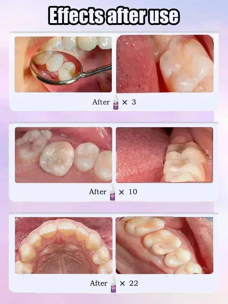 Hot sales Best-selling, Scient - đánh giá và giá Teeth Whitening That Works