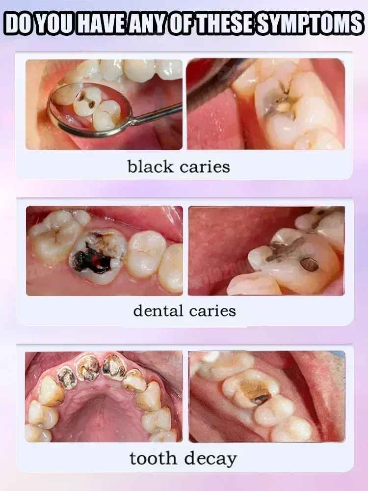 Hot sales Best-selling, Scient - đánh giá và giá Teeth Whitening That Works