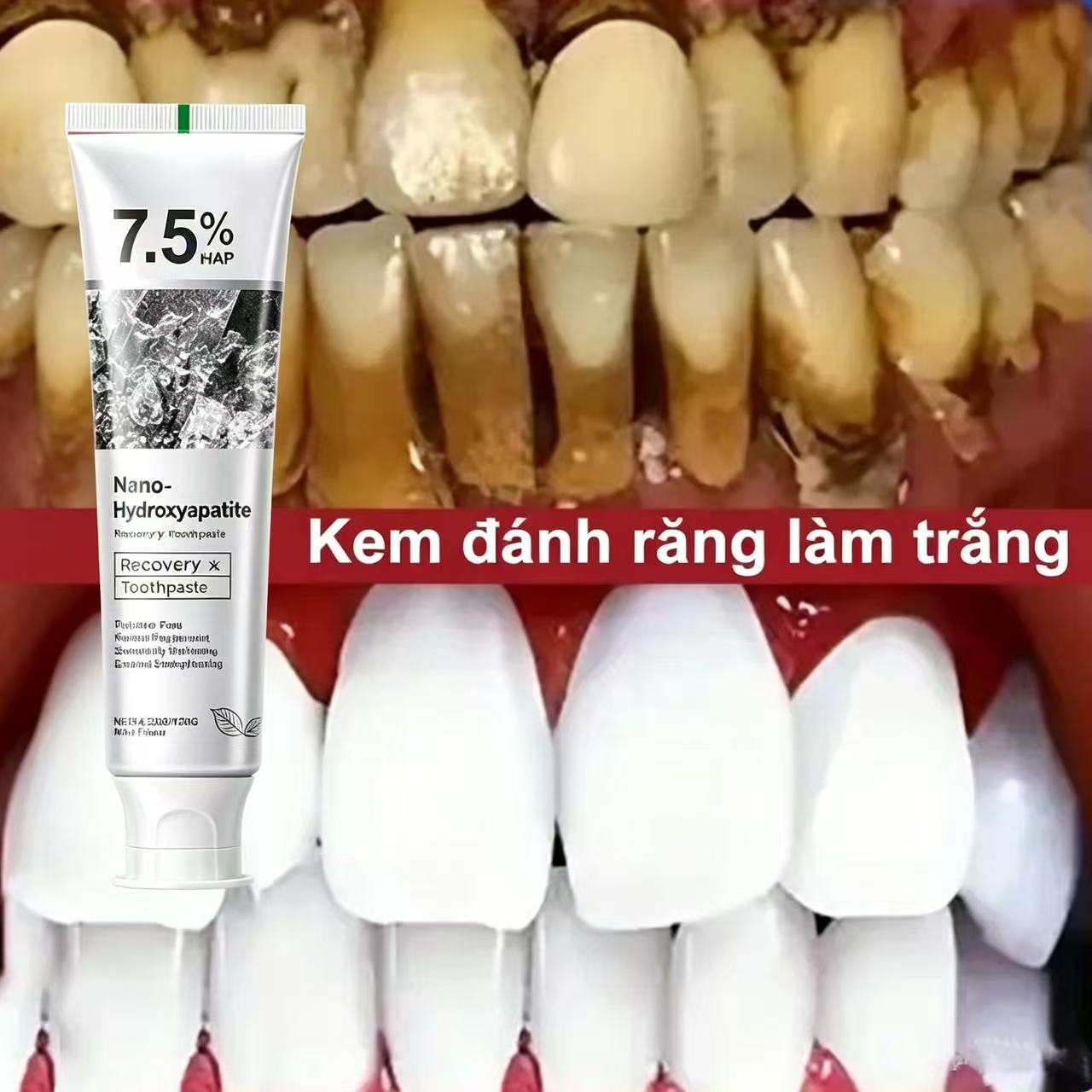 7.5% Hydroxyapatite Probiotic  - đánh giá và giá Teeth Whitening That Works