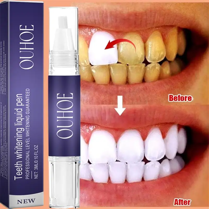 Fast Teeth Whtening Toothpaste - đánh giá và giá Whitening Pen Bleach