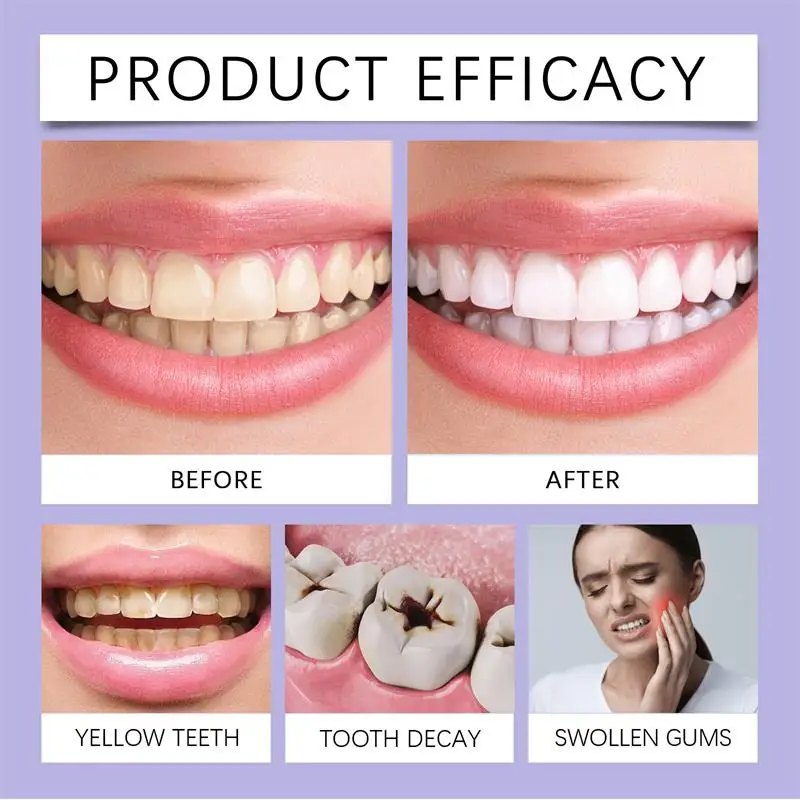 Fast Teeth Whtening Toothpaste - đánh giá và giá Whitening Pen Bleach