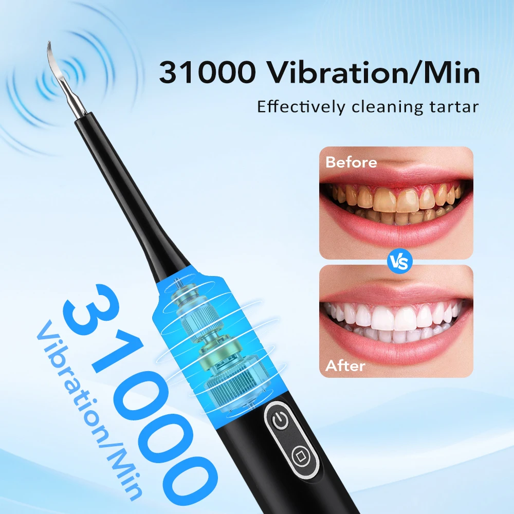 Electric Sonic Vibration Denta - đánh giá và giá Teeth Whitening Toothbrush